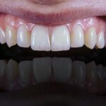 oral health