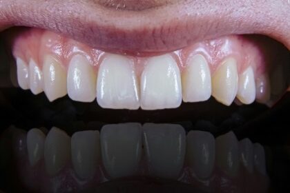 oral health