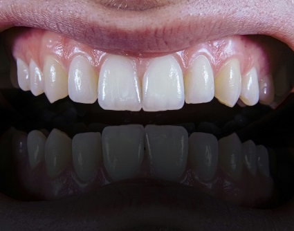 oral health