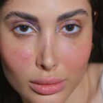 skin health