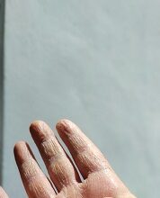 winter skin care