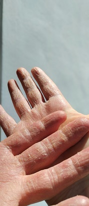 winter skin care